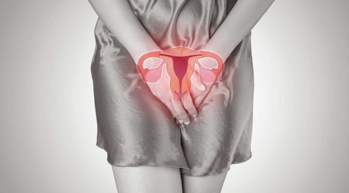 El síndrome del ovario poliquístico y la infertilidad