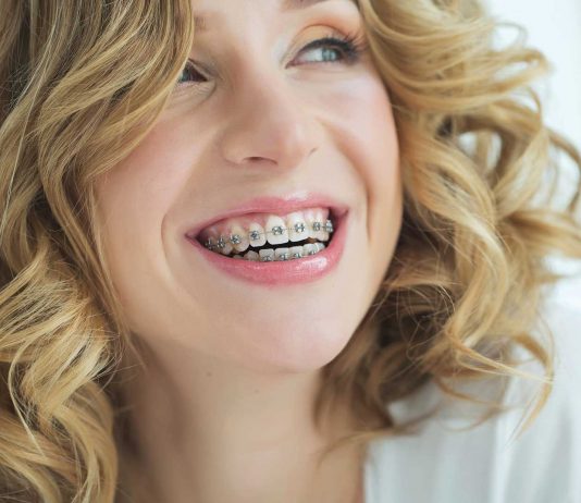 ¿Es compatible usar ortodoncia durante el embarazo?
