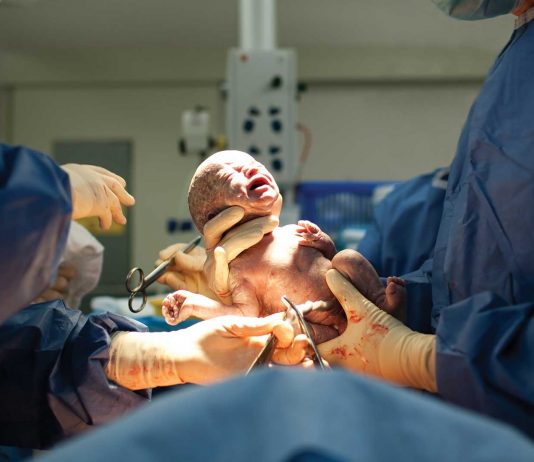 Ventajas y desventajas de la cesárea programada vs parto natural