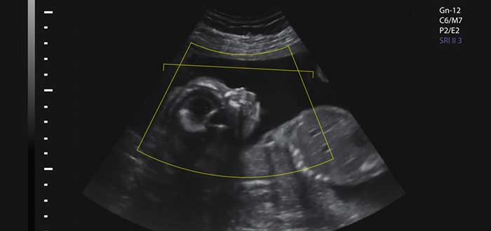 La importancia de la ecografía para ver la evolución del feto