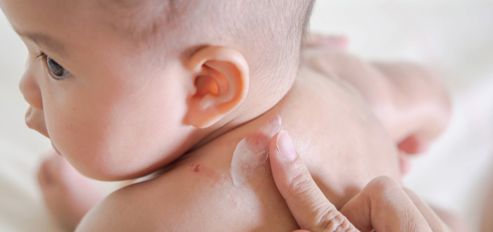 Tips para cuidar la piel del bebé